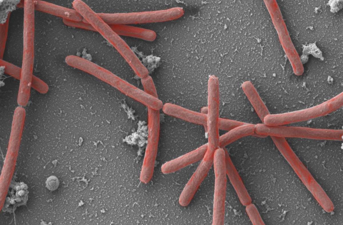 Methanothermobacter ist Mikrobe des Jahres 2021